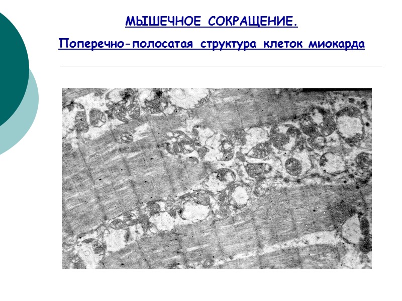 МЫШЕЧНОЕ СОКРАЩЕНИЕ.  Поперечно-полосатая структура клеток миокарда